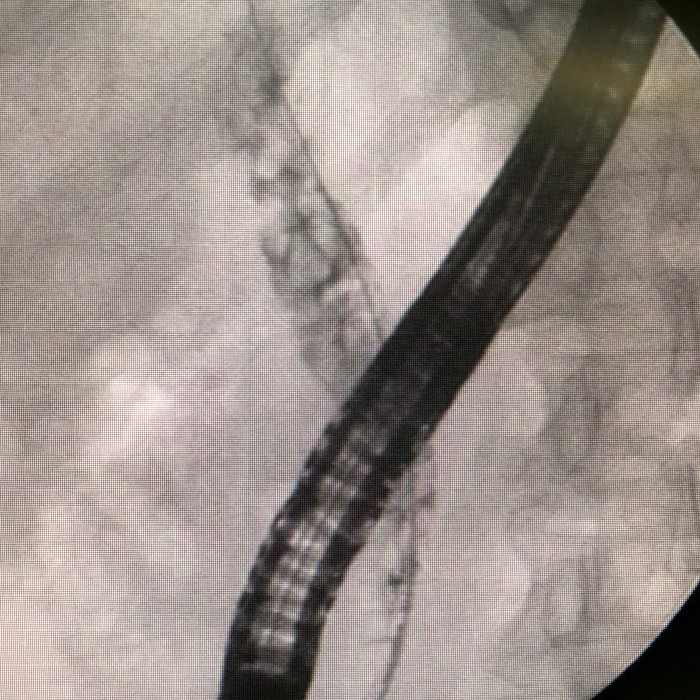 webwxgetmsgimg (2).jpg